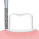 Restorative(For Preparation of crown cores)/S82D -AIR SCALER